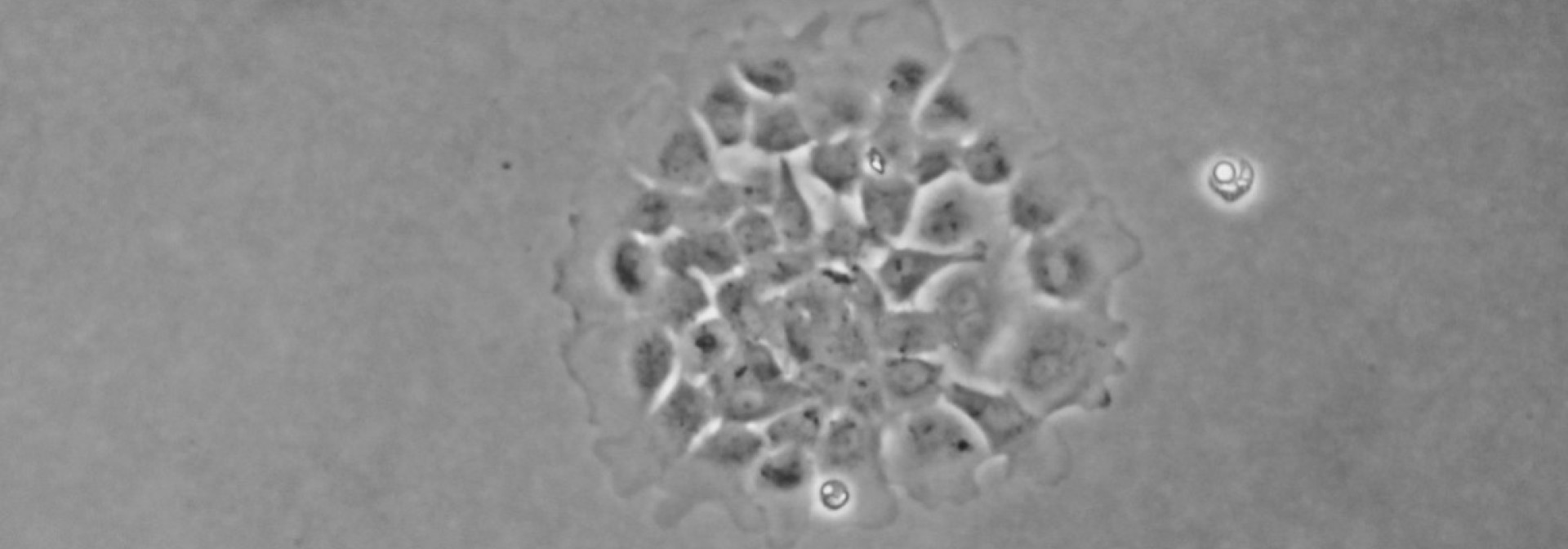 Blastema cells