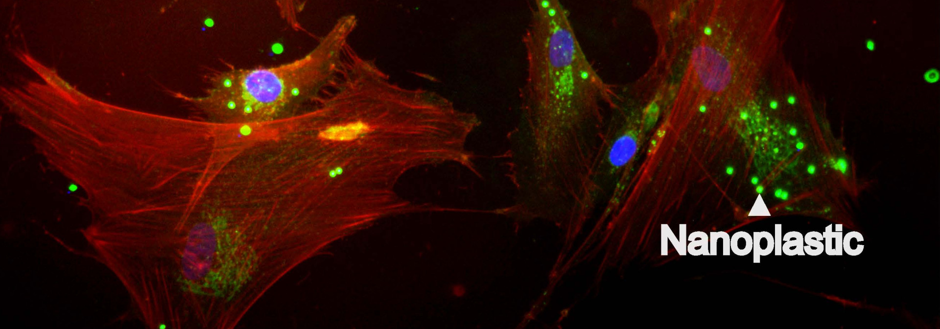 Human skin cells with nanoplastics