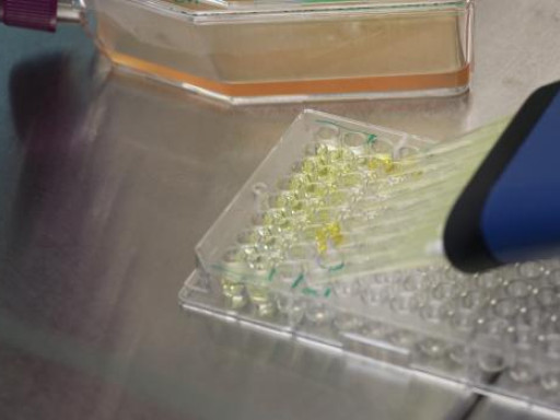 Novo biomarcador ajuda a detetar doenças cardiovasculares em doentes renais Generic representation of Novo biomarcador ajuda a detetar doenças cardiovasculares em doentes renais