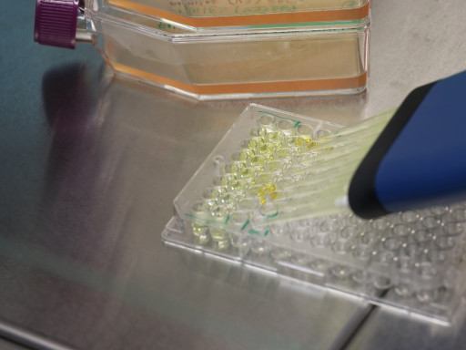 Generic representation of Novo biomarcador ajuda a detetar doenças  cardiovasculares em doentes renais