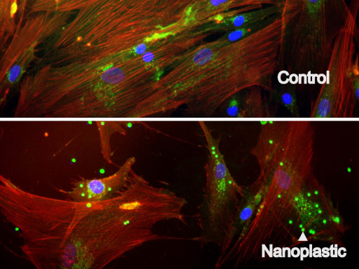 Human skin cells with nanoplastics