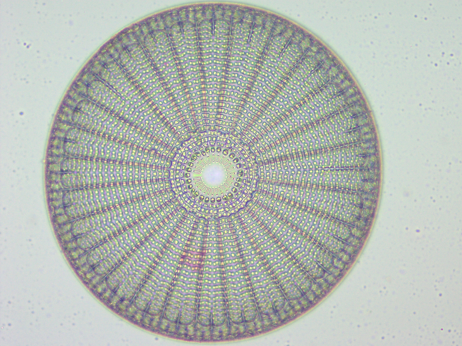 Arachnoidiscus