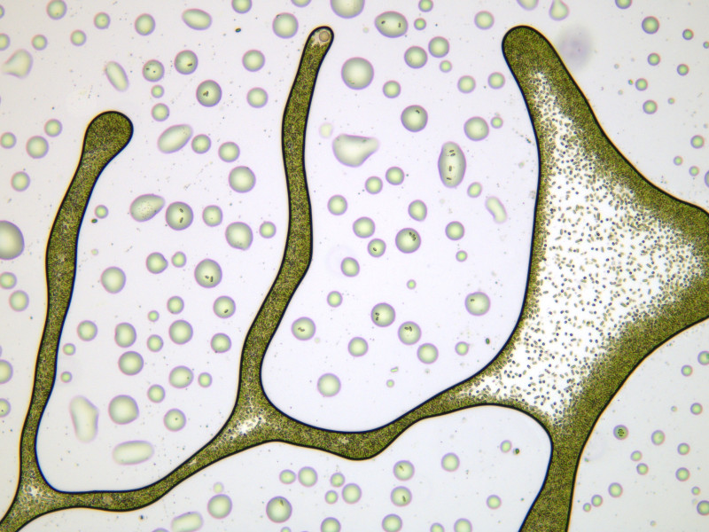 Microalgae (Stichococcus sp.) condensed in evaporated patterns. MarBiotech Group.