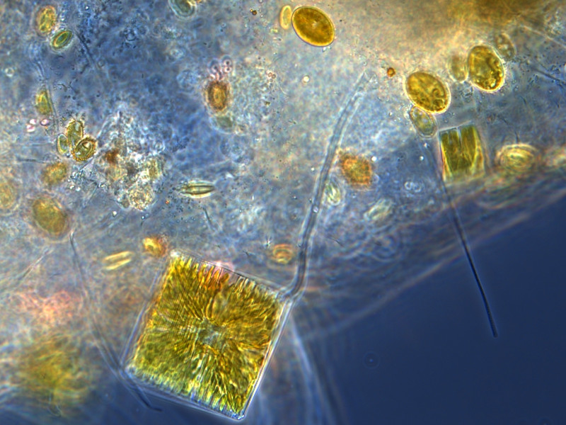 Phytoplankton from water sample collected in Ria Formosa. Sample Courtesy: Joana Cruz, EcoReach Group