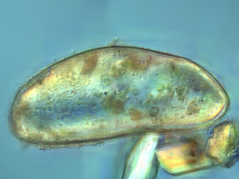 Image of a bivalve larvae with sand grains, acquired with Differential Contrast Microscopy (DIC)