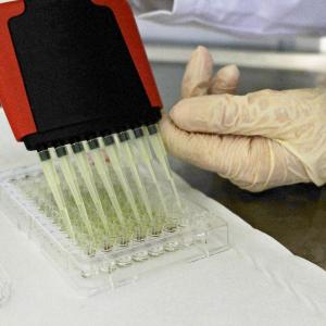 Detail of researcher's hand at work