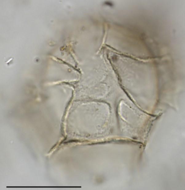 Impagidium detroitense, a dinocyst species I discovered. It is endemic from the Pacific Ocean.