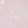 Diatom (Chaetoceros sp.) in sea water collected from the beach of Faro Island. Sample courtesy: Gabriel Bombo, GreenCoLab