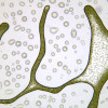 Microalgae (Stichococcus sp.) condensed in evaporated patterns. MarBiotech Group.