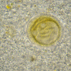 Mussel reproductive cells (oocyte and spermatozoa). Sample courtesy: Zhi Li (CEIB Group) and Ilaria Savino (University of Bari, Italy).