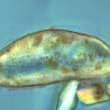 Image of a bivalve larvae with sand grains, acquired with Differential Contrast Microscopy (DIC)